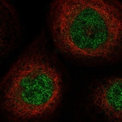 SLC25A43 Antibody, Novus Biologicals 0.1mL; Unlabeled:Antibodies, Polyclonal